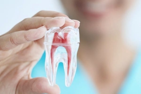 Root Canal Treatment at Just Dent